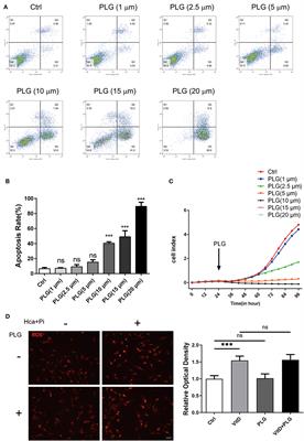 Piperlongumine Attenuates High Calcium/Phosphate-Induced Arterial Calcification by Preserving P53/PTEN Signaling
